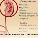 bladder_infection_itch_edited